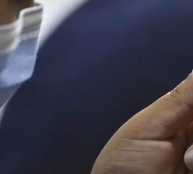 Suben a 86 los casos de sarampión en Bolivia 